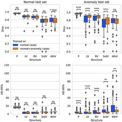Deep learning-based segmentation of brain parenchyma and ventricular system in CT scans in the presence of anomalies